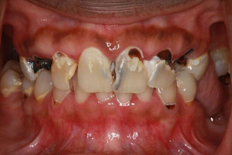Before