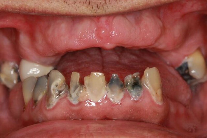 Before