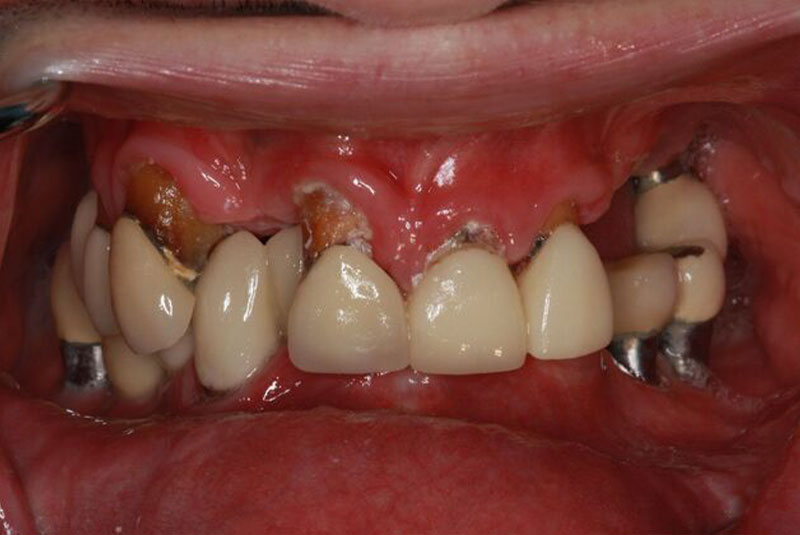 Before